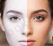 سفید کردن صورت